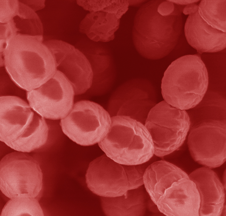 The Almost Offical Wisconsin State Microbe is Lactococcus lactis.